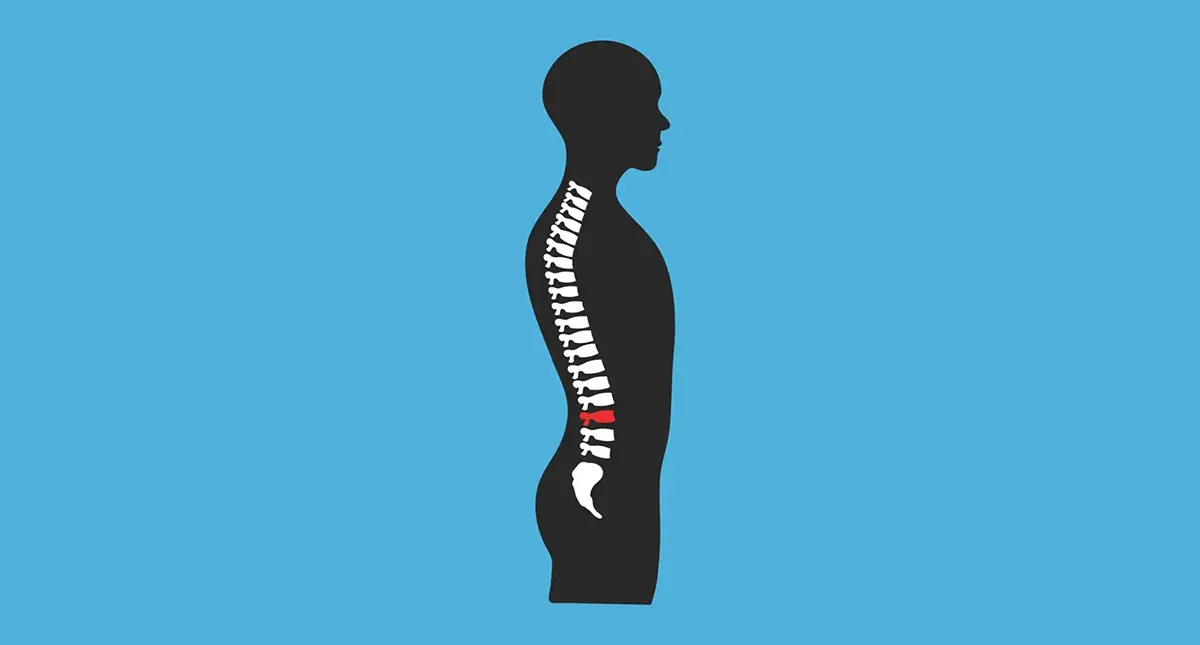 Minimally invasive spine surgery being performed with tubular instruments and imaging guidance