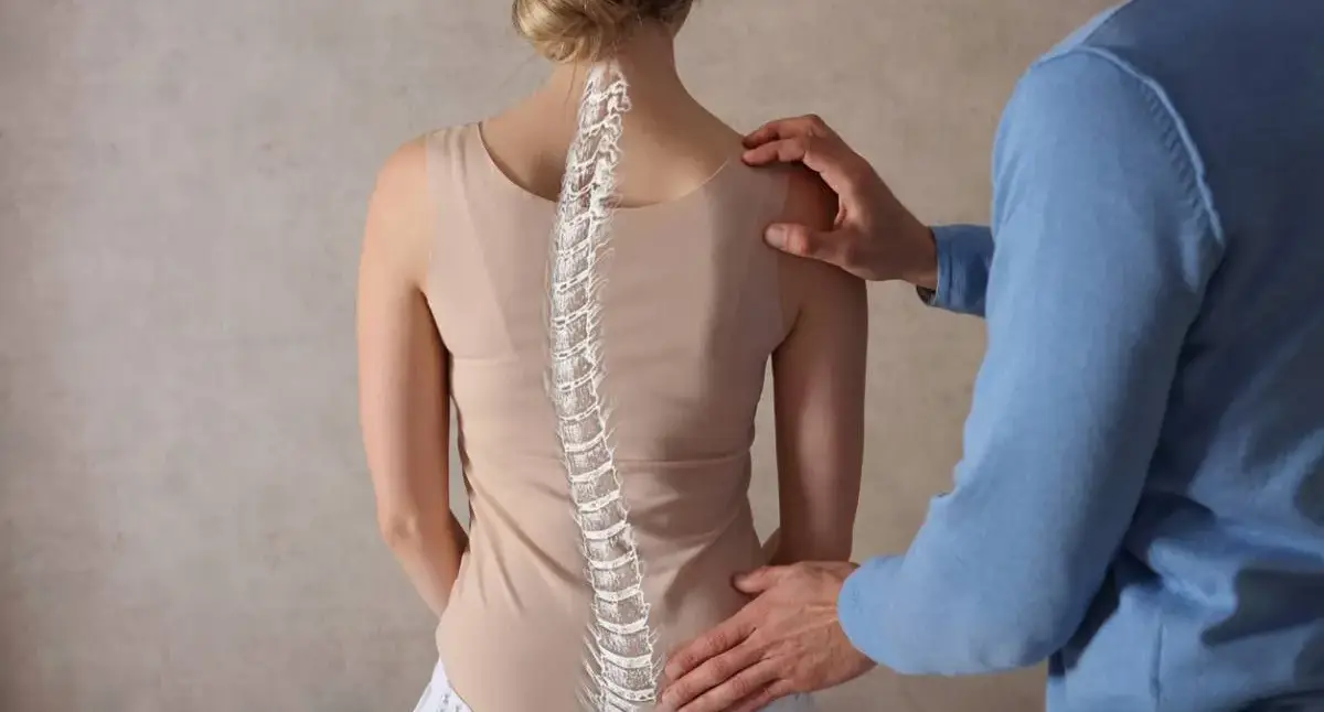 Spine model showing nerves and areas treated with spinal decompression surgery