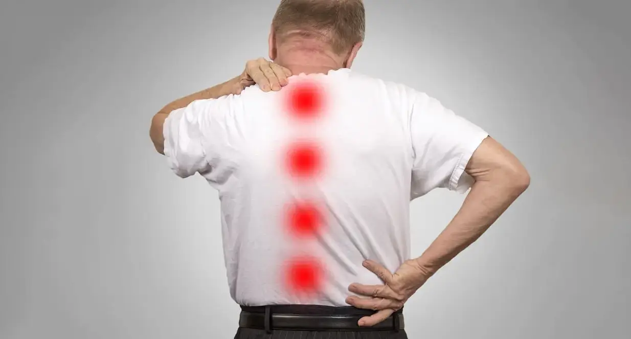 Spinal canal narrowing in the neck and low back pressing on nerves, a common cause of spinal stenosis pain and numbness