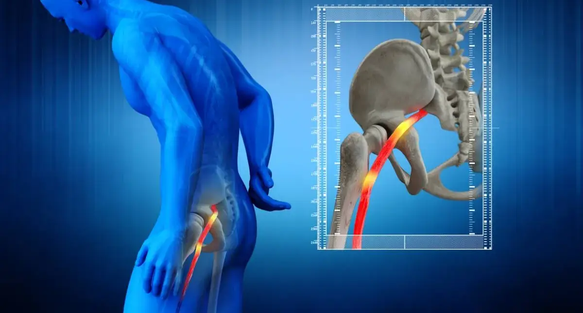 Adult holding the lower back with pain radiating into the leg, an early sign of sciatica