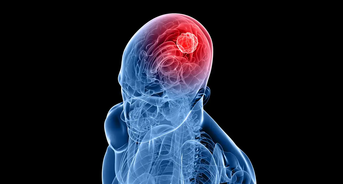 Patient discussing new neurological symptoms with a neurosurgeon in Los Angeles