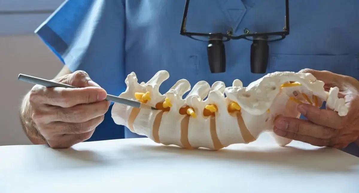 Spine illustration showing a small bony overgrowth (osteophyte) near a vertebra that may narrow the space for a nerve