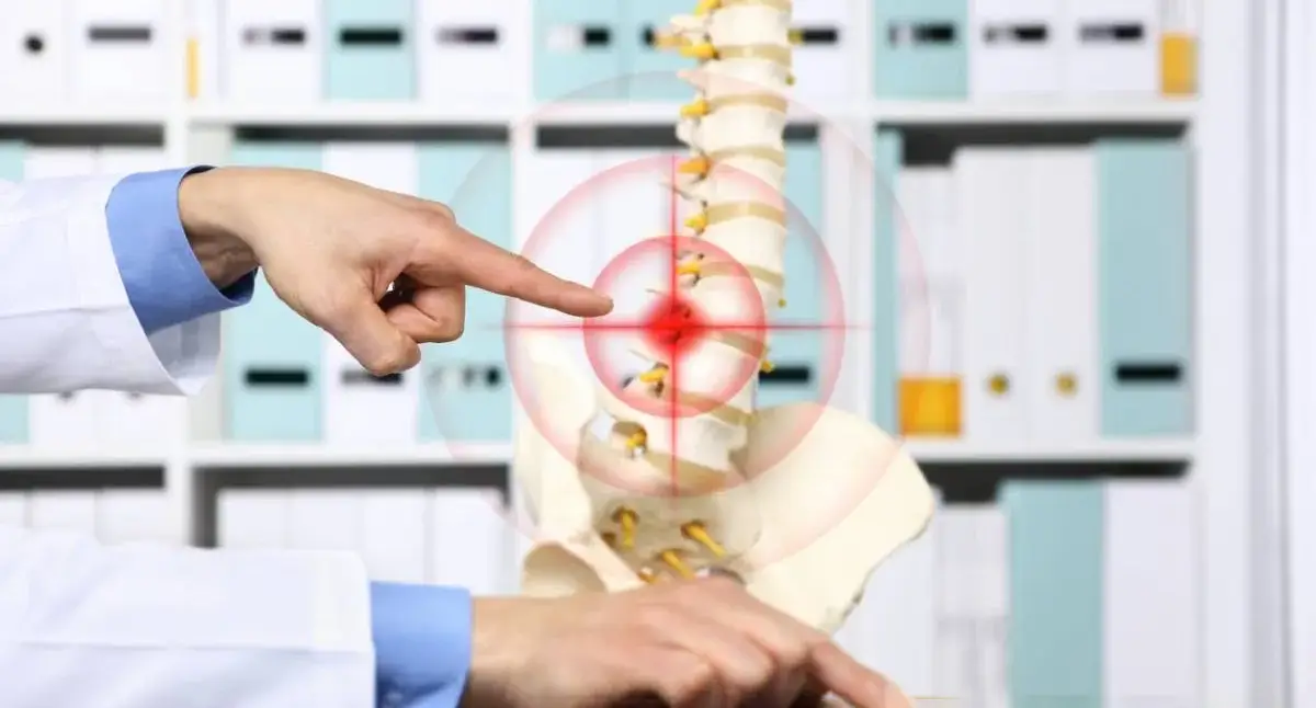 Anatomical spine model showing intervertebral discs between the vertebrae