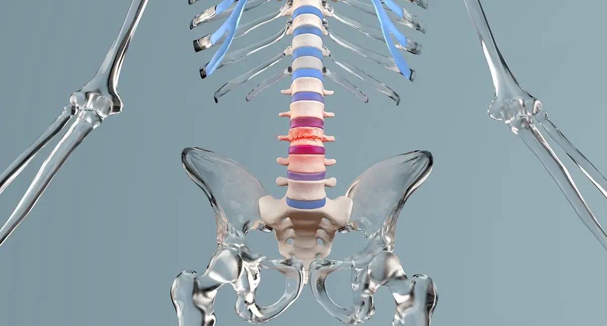 Person holding their lower back while walking, a common challenge for people with spinal stenosis