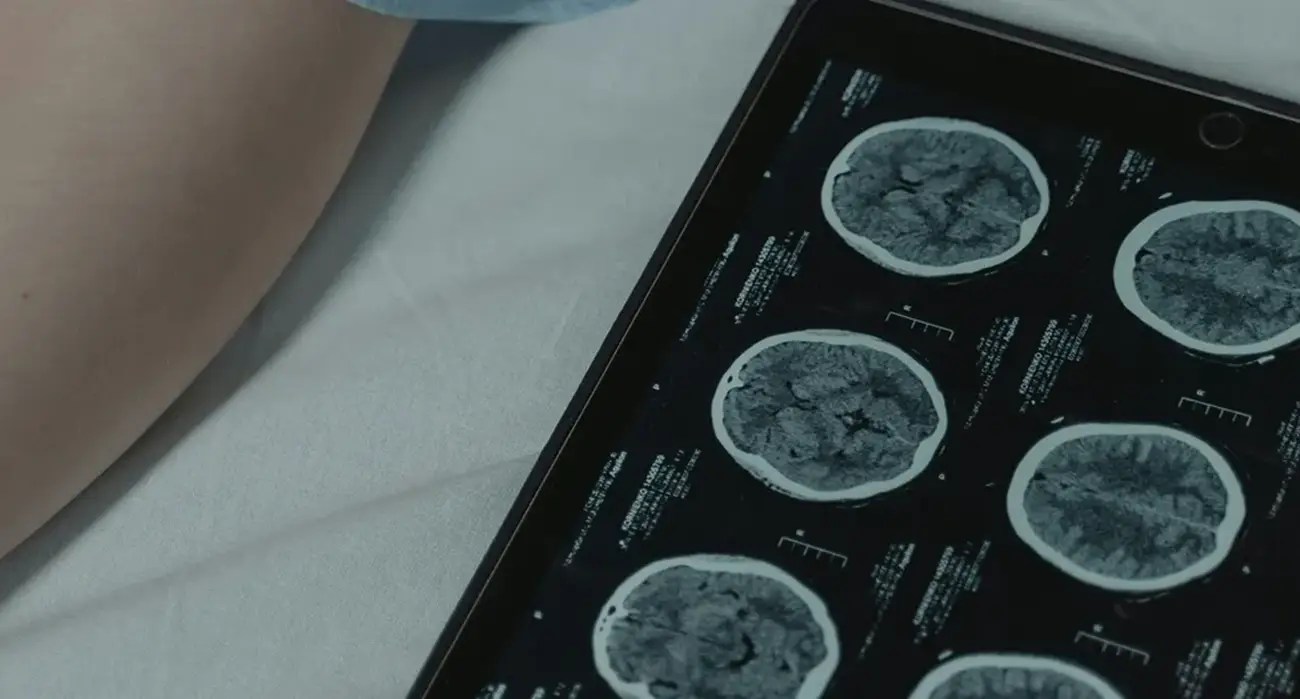 A set of brain scans lies next to a patient in a hospital bed, indicating a serious condition of the brain in Los Angeles