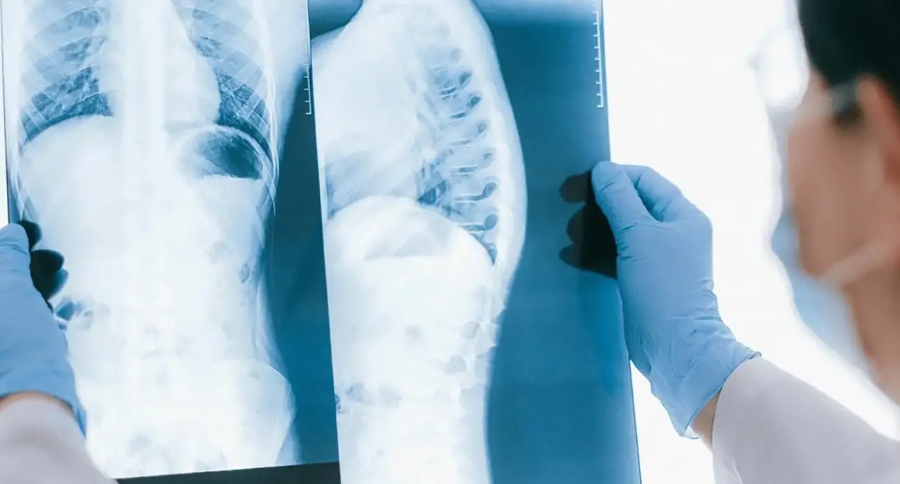 A doctor looks at a patient’s X-rays of the spine to determine the best solution for their spine condition in Los Angeles