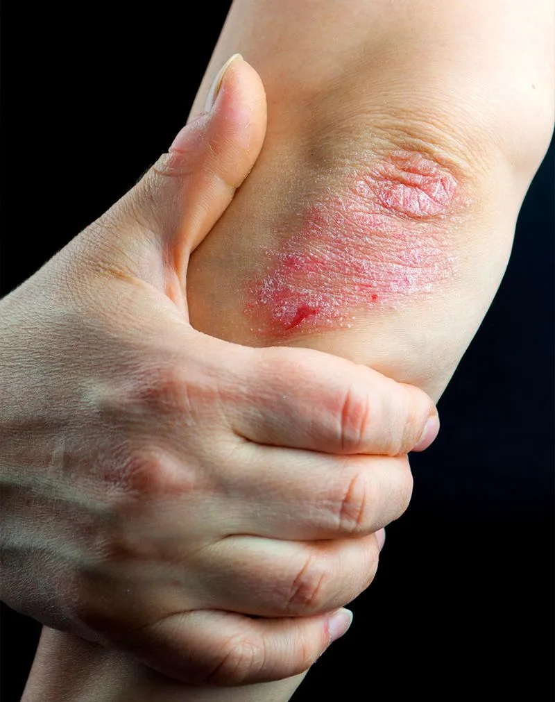 Dermatological Compounds