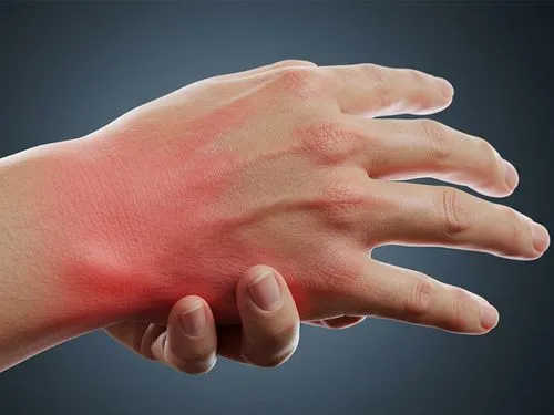 Neuropathic Pain Medications