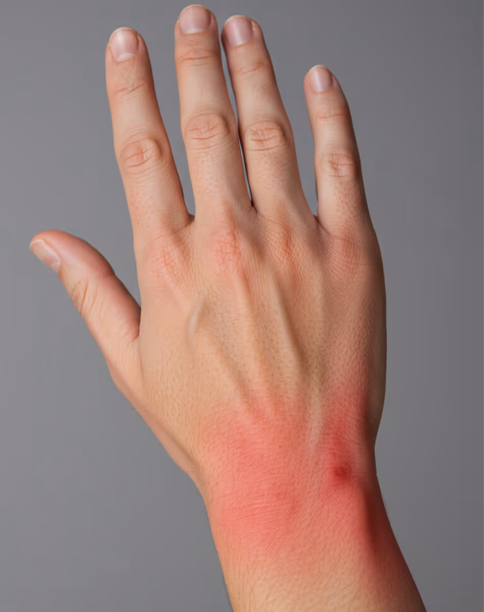 Neuropathic Pain Medications
