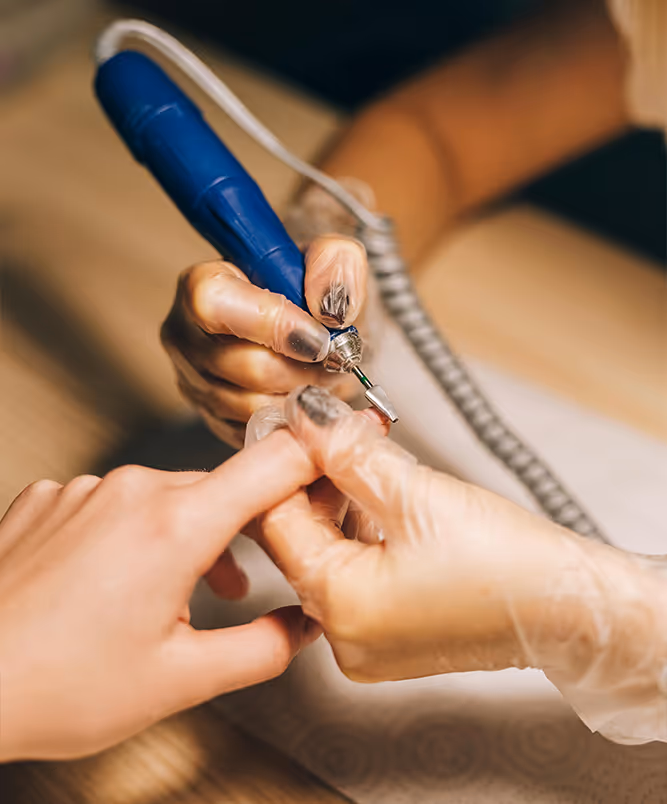 Nail Infection Removal