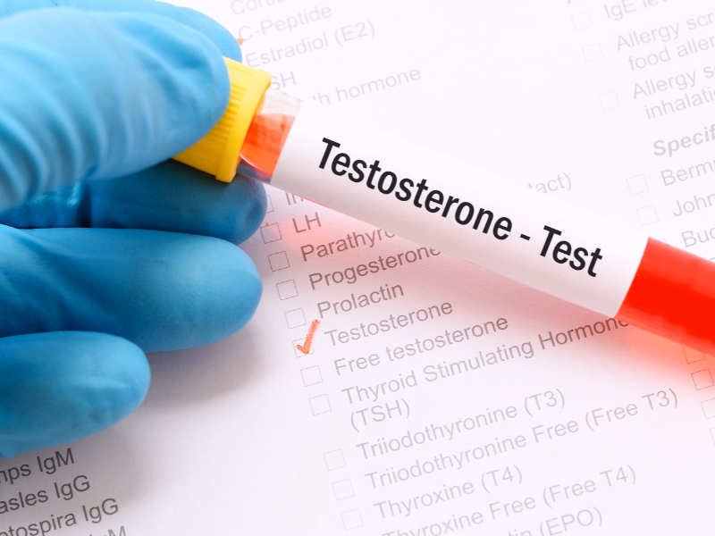 Understanding Testosterone and Its Role in Men’s Health