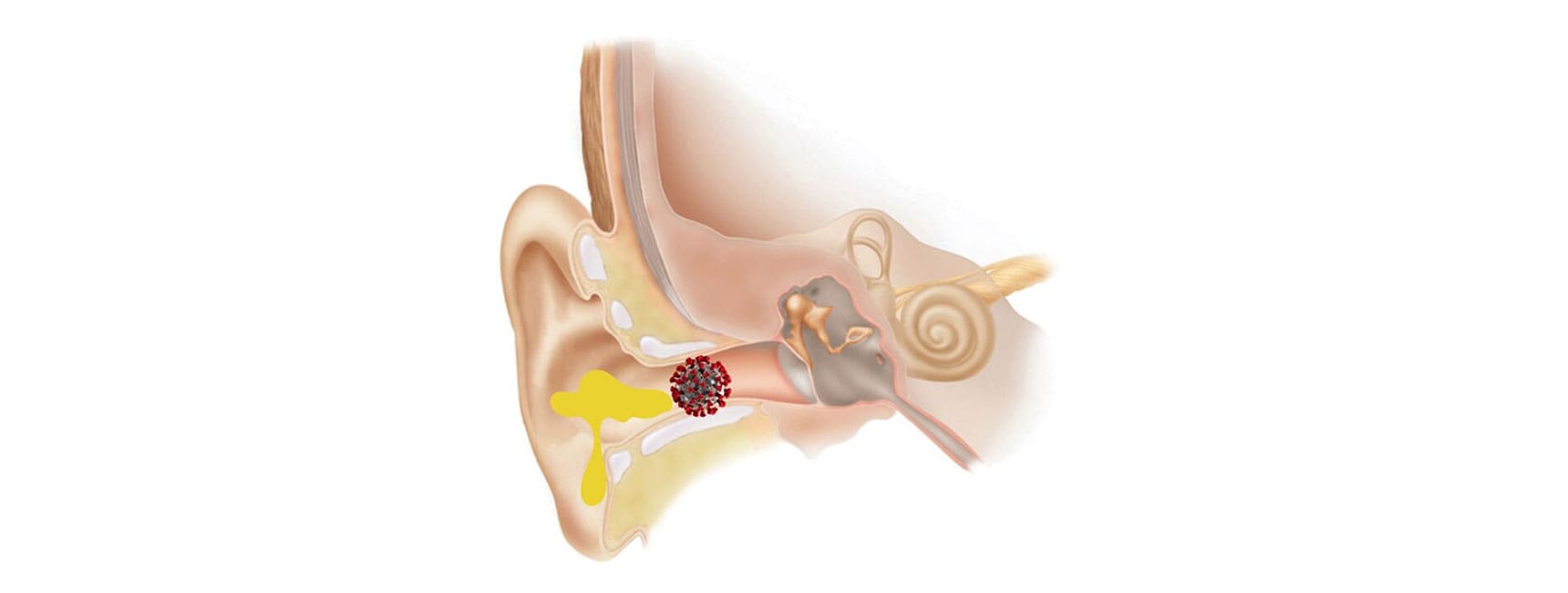Blog Post Image
