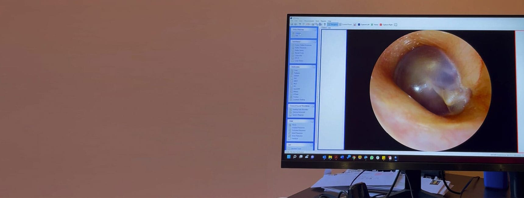 Blog Post Image
