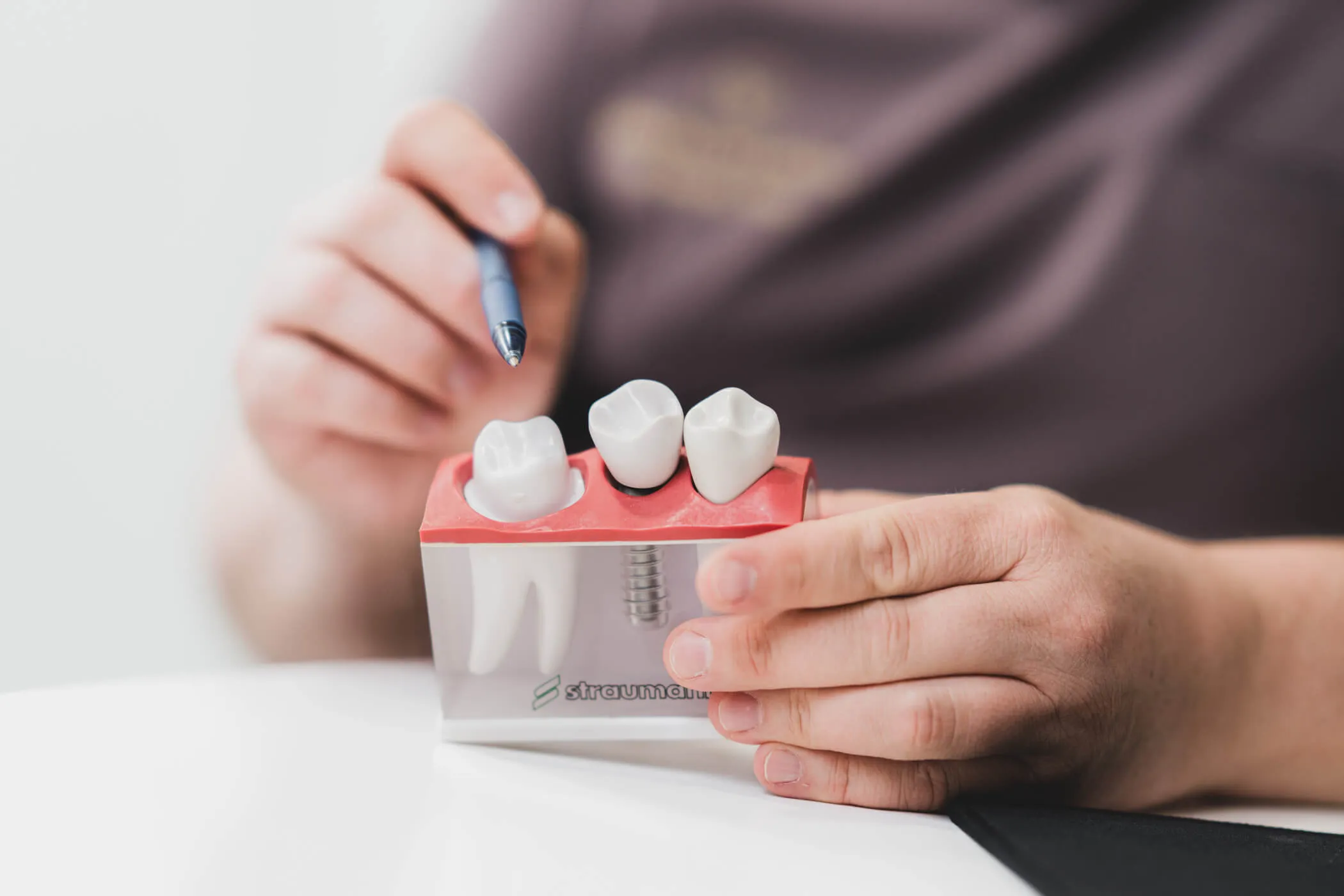 implant-zebowy-korona-na-implancie-warszawa-wilanow