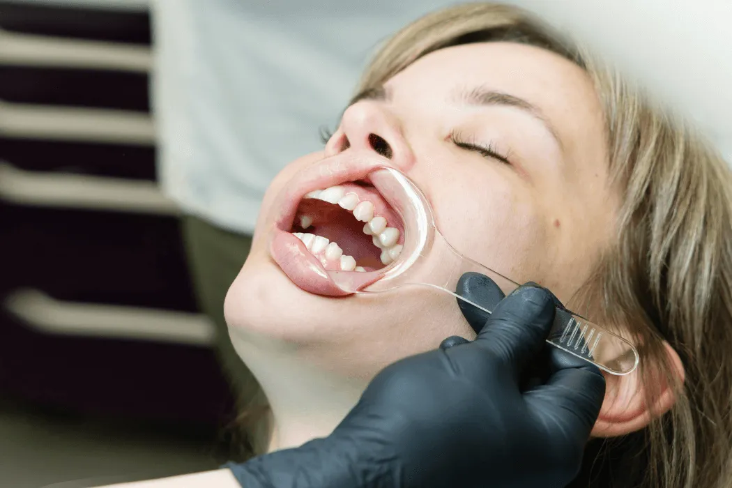 periodontologia-warszawa-wilanow-klinika-stomatologiczna