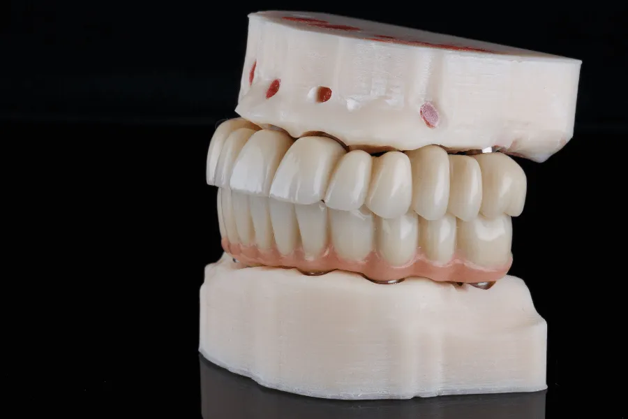 all-on-4-all-on-6-dental-wilanow-warszawa