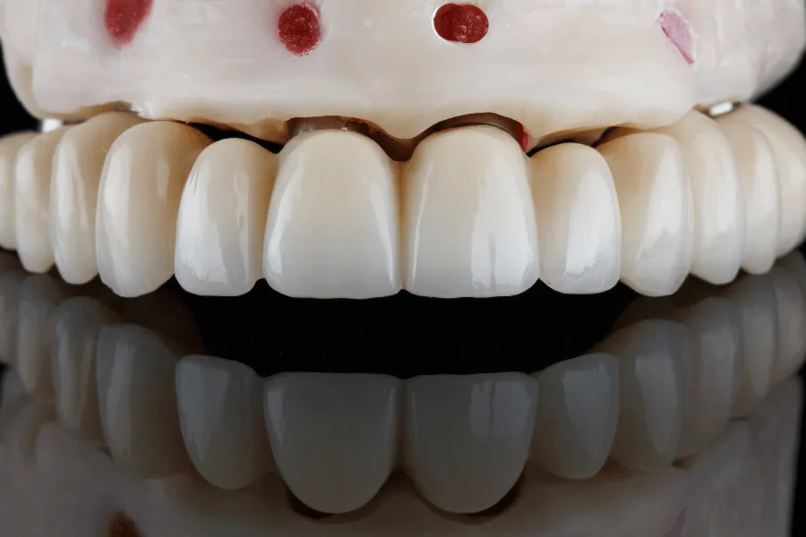 nowe-zeby-w-jeden-dzien-dental-wilanow-warszawa