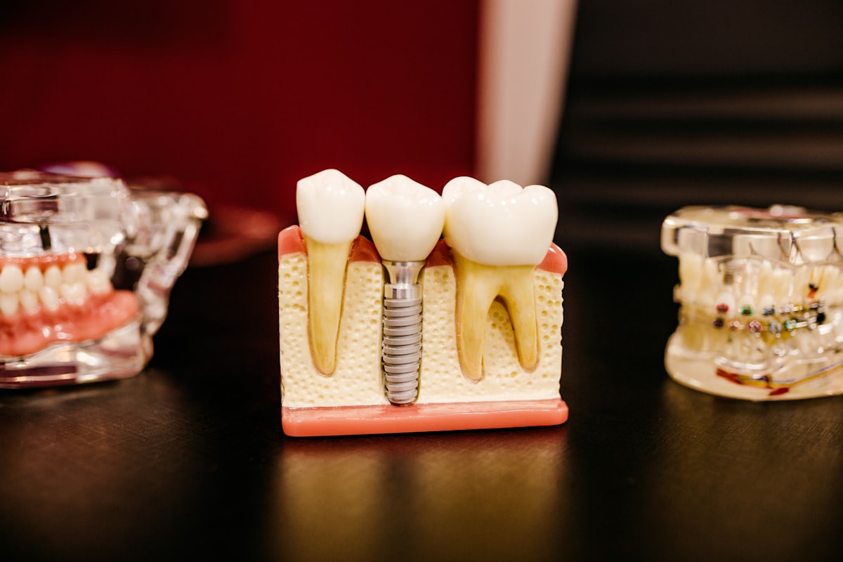 Model implantu zęba obok naturalnych zębów