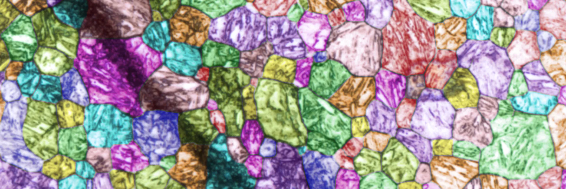 Ehemalige Austenitkörner (mit Seigerungen und Präparationsartefakten)