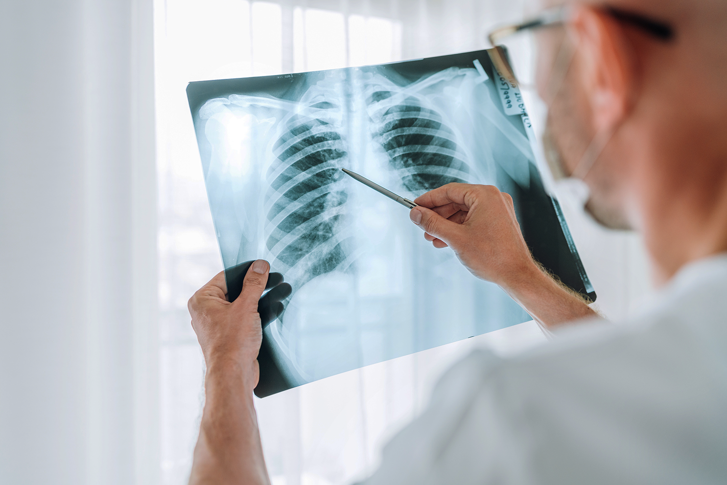 Doctor wearing a mask examining a chest X-ray film with a pen pointing to the lungs.