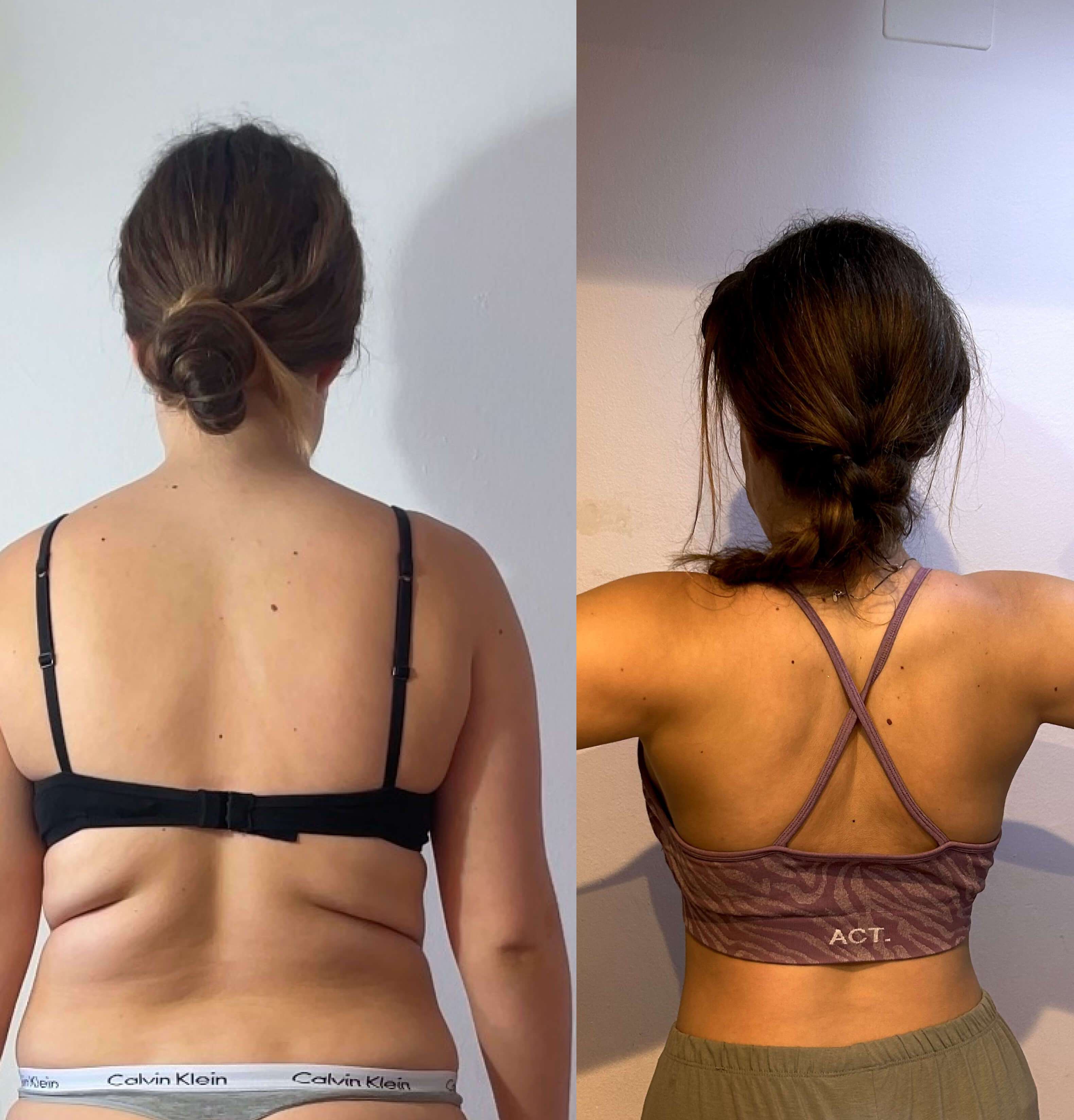 Side-by-side comparison of a woman's back before and after weight loss, wearing different bras and with hair tied up.