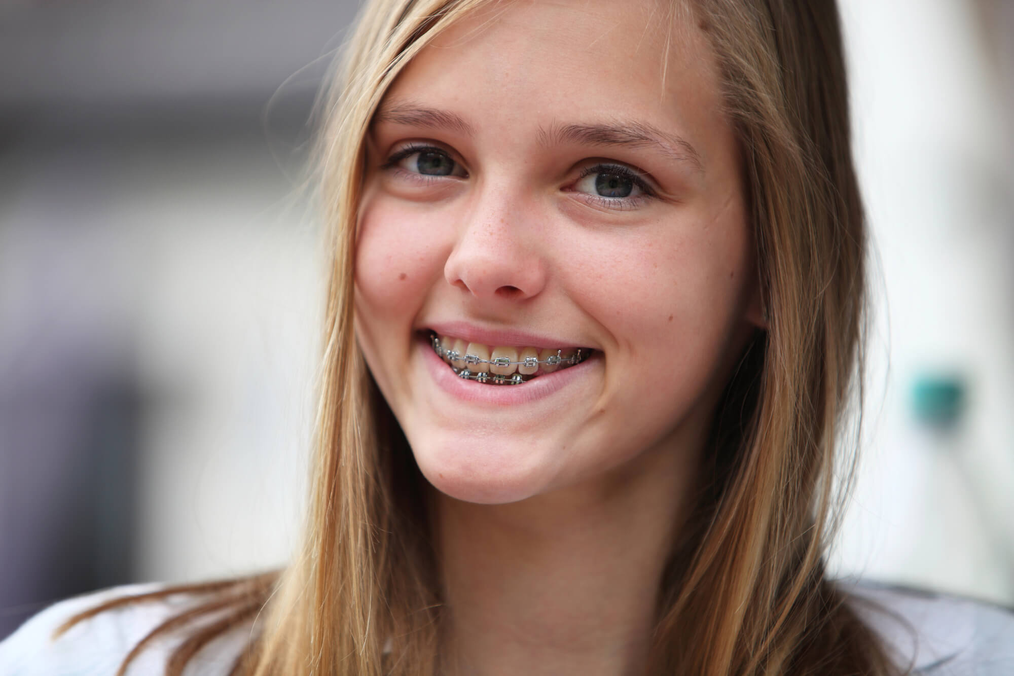 Causes for Crooked Teeth That Need Braces or Invisalign in Nashville