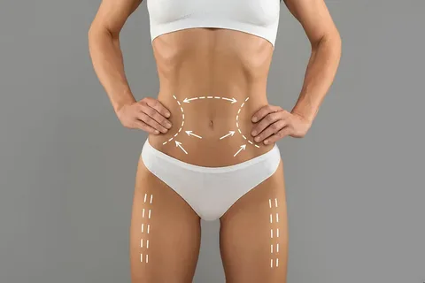 Residents searching for the best body contouring options in Oceanside want real answers about what actually works for stubborn fat, sagging skin, and long-term confidence. Clinics across California promote advanced body contouring procedures, yet not every