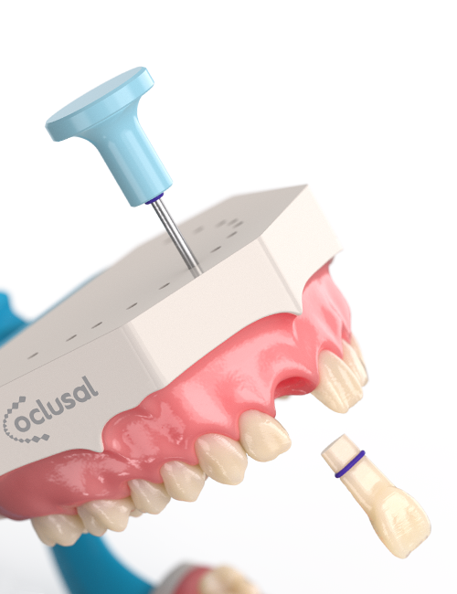 Dental model showing a blue pushpin inserted in a white base labeled 'occlusal' with a set of teeth attached, and a separate artificial tooth with a blue ring below it.