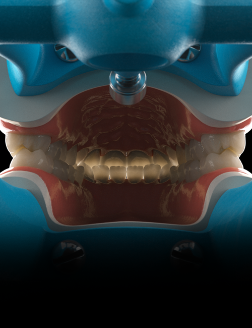 Close-up view inside a dental mold machine showing a full set of artificial teeth in a pink gum mold with blue exterior, illuminated from above.