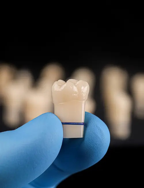 Blue-gloved hand holding a dental crown against a black background with blurred dental crowns in the background.