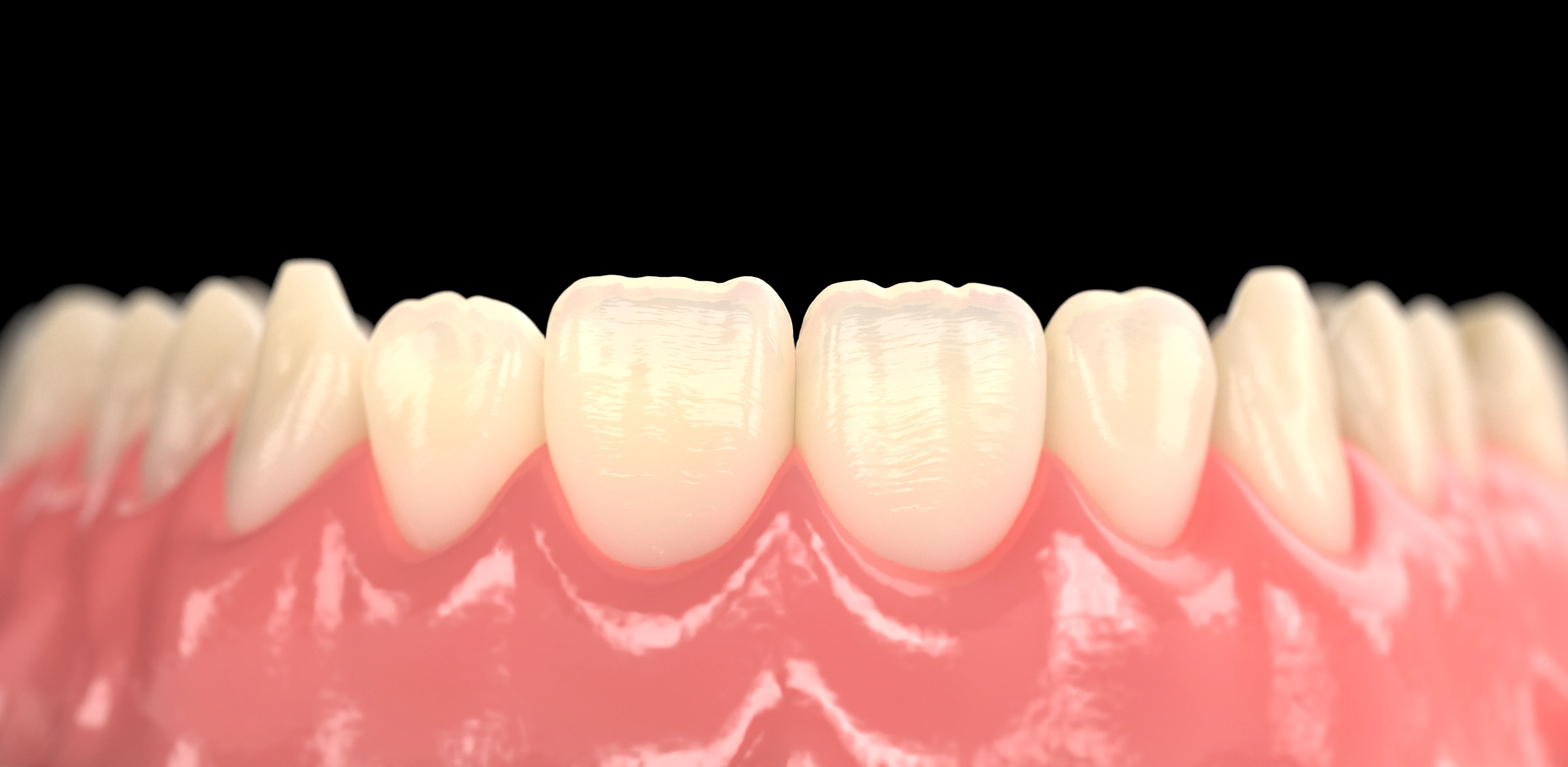 Close-up view of upper front teeth embedded in pink gums against a black background, showing detailed enamel texture and natural tooth shapes.