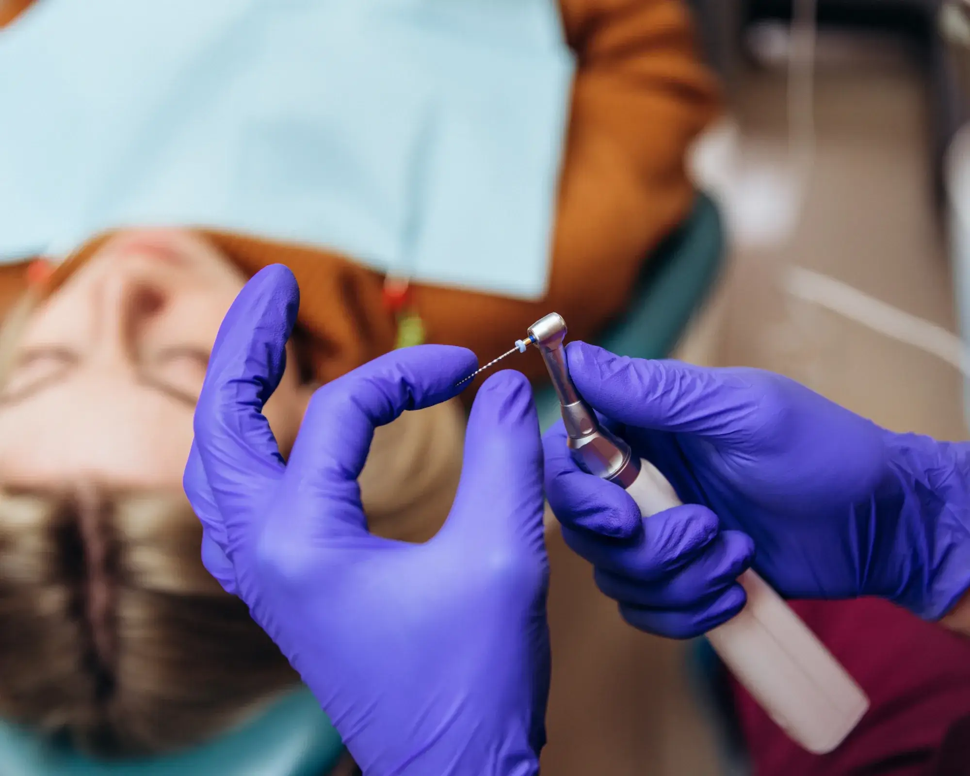 Gloved hands holding a dental drill with a small file near a patient's mouth in a dental office.
