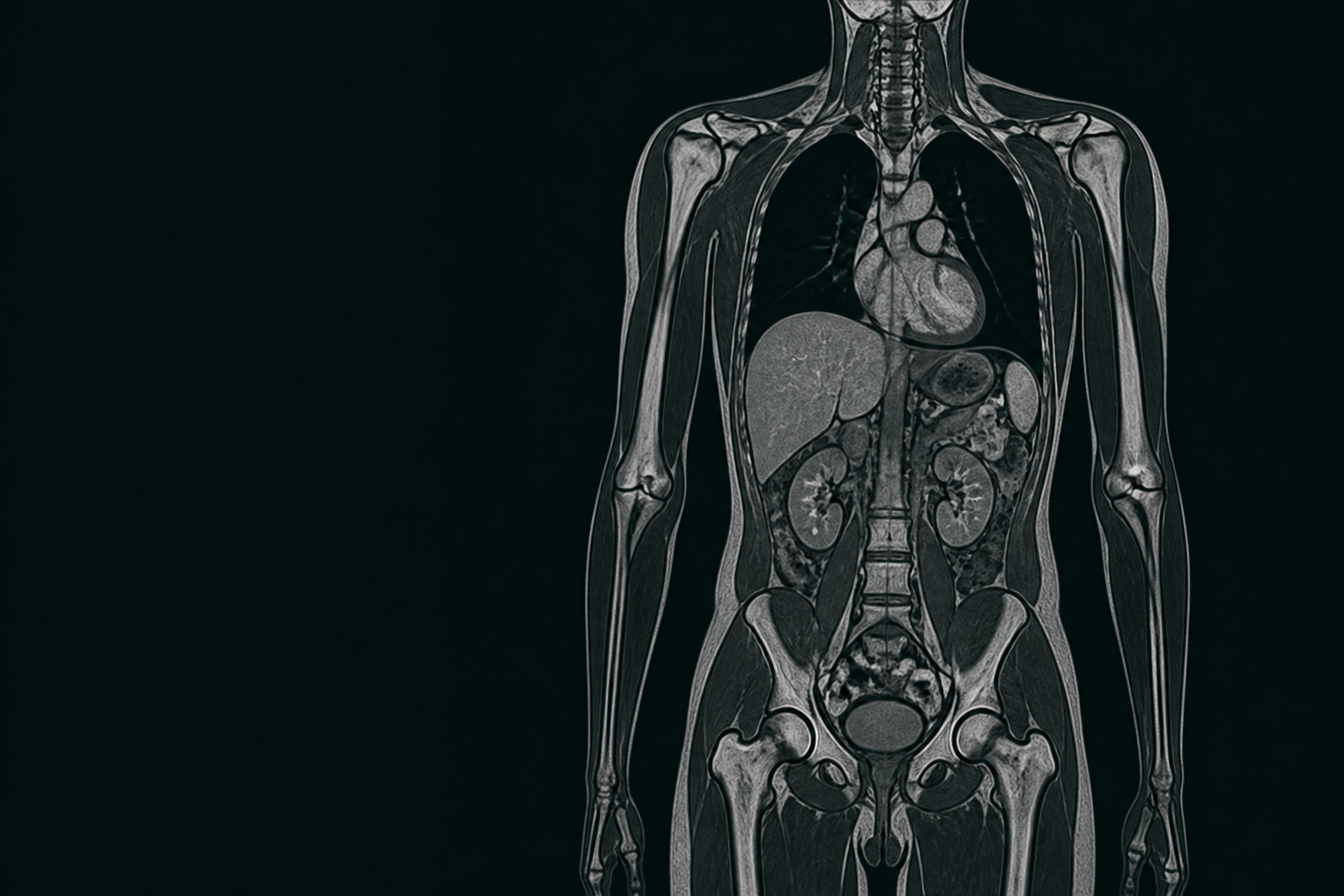 Whole-body imaging placeholder for DXA