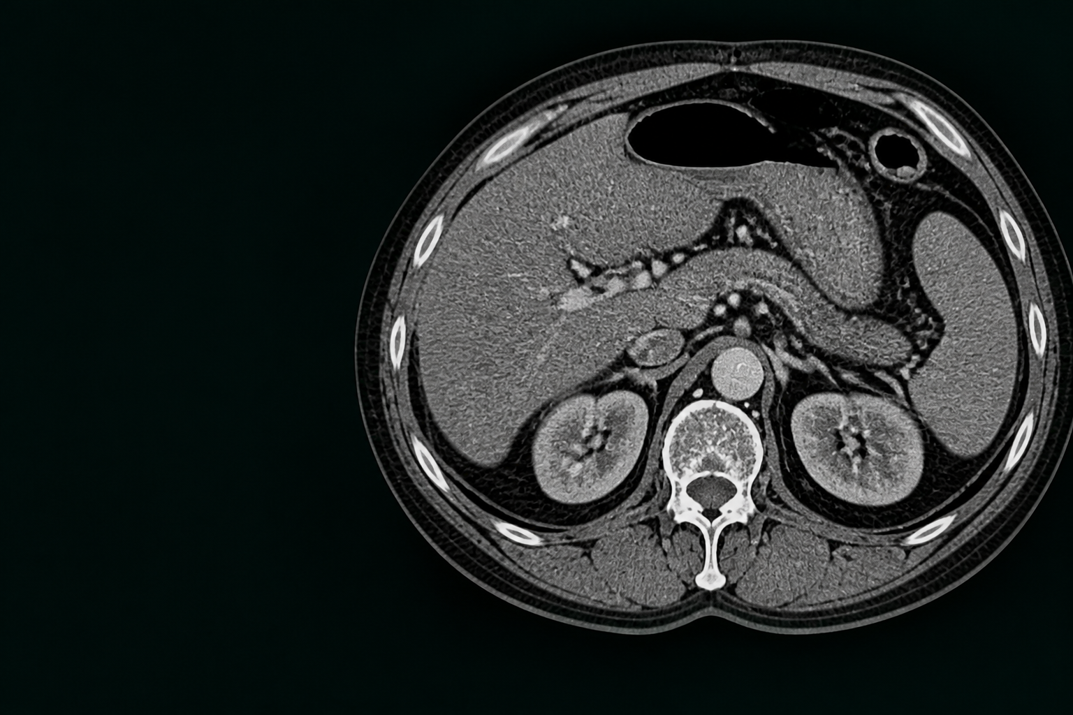 CT scan imagery
