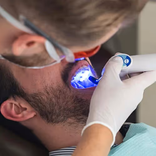 Starostlivosť o zubnú dutinu. 7 krokov, ktoré vám ušeria 560€. » Najlepší Zubár v Poprade? » Zubná ambulancia MIMIK