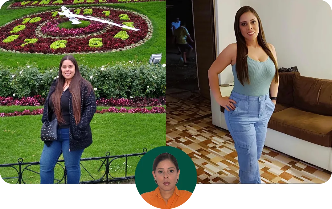 Testimonial of before and after in Teleweight and Wellness Clinic