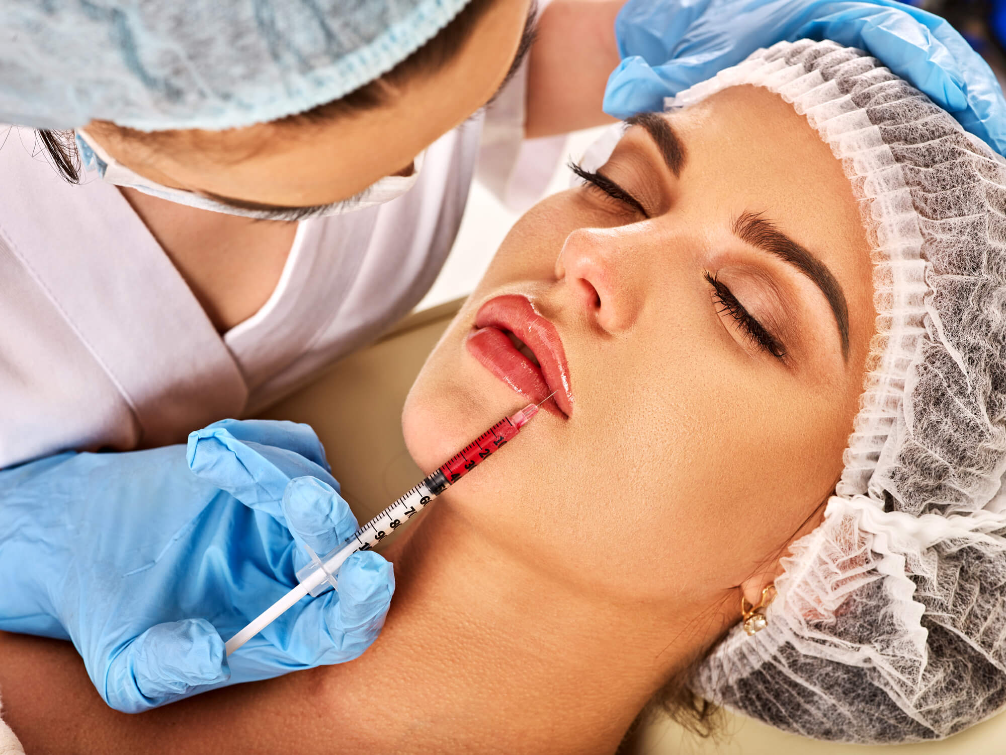 ongoing appointment for dermal fillers in tampa