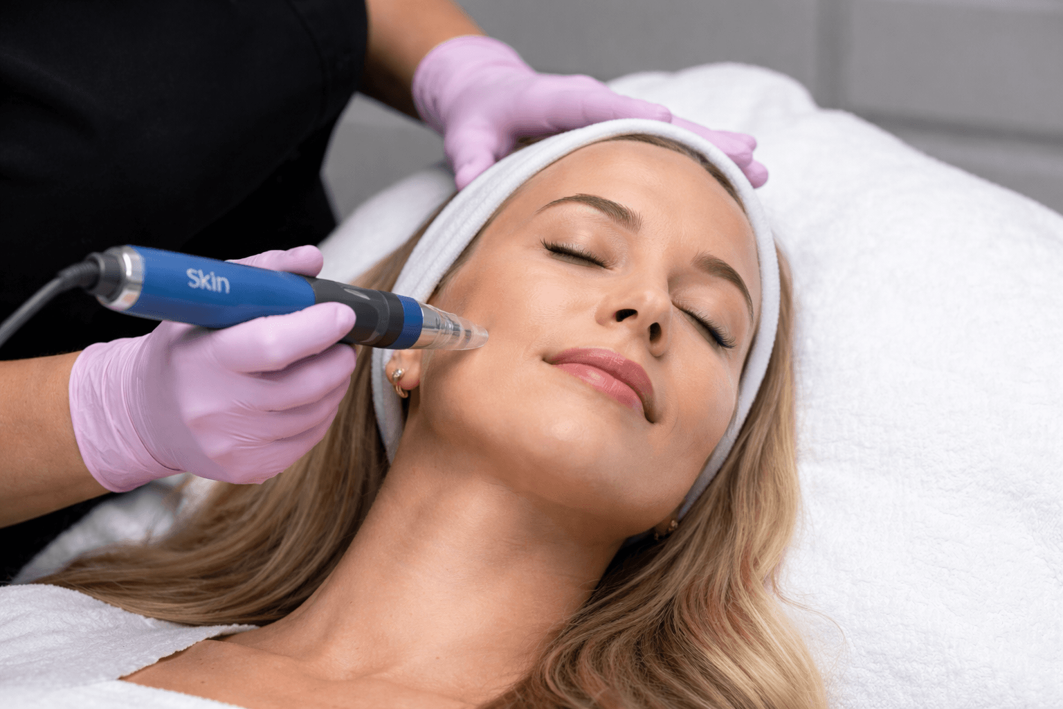 Microneedling treatment in Draper, Utah stimulating collagen for smoother skin at True Medical Spa