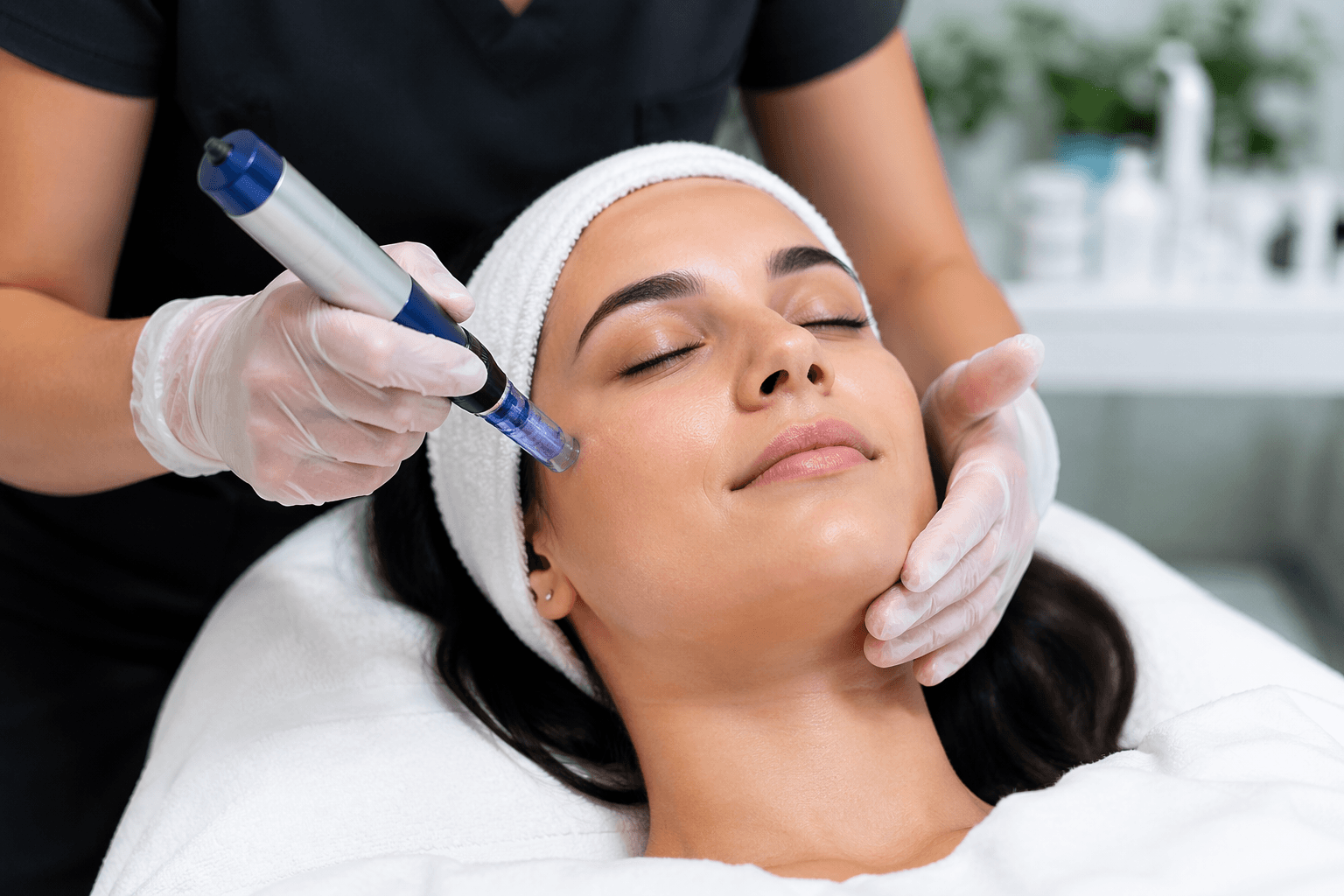 SkinPen microneedling treatment improving skin texture in Draper, Utah medical spa