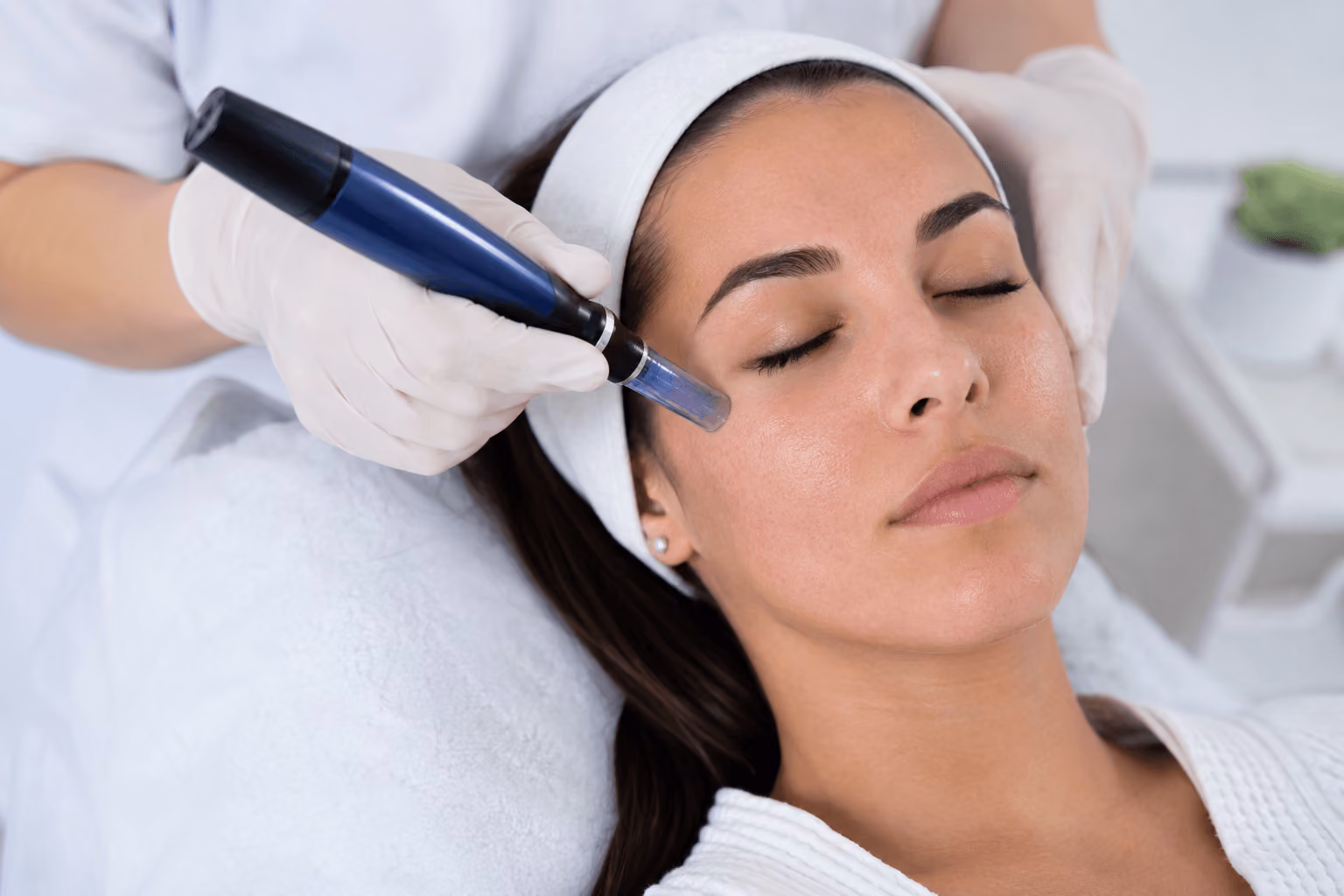treatment-for-acne-scars-draper-utah