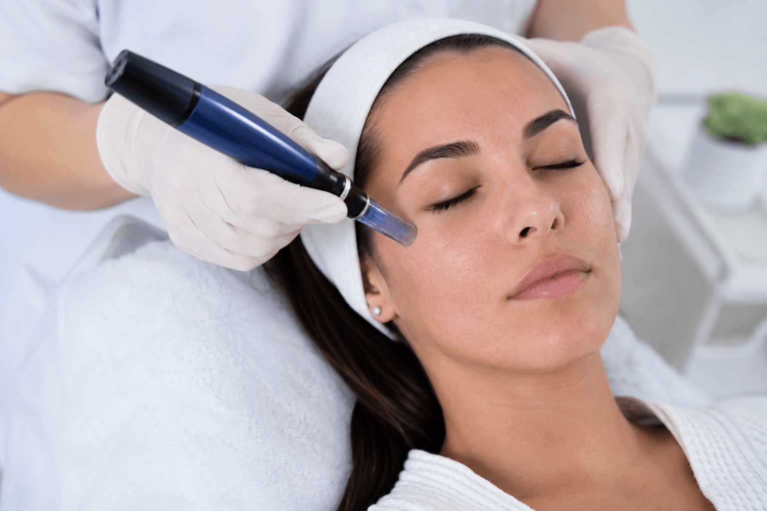 treatment-for-acne-scars-draper-utah