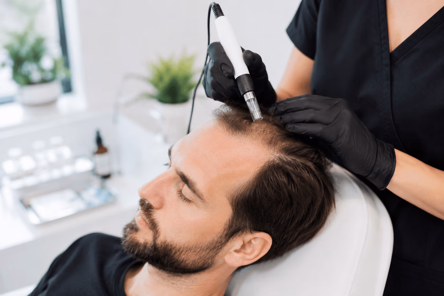Provider performing regenerative microneedling treatment on a patient's scalp for early hair thinning at an aesthetic clinic in Draper, Utah.