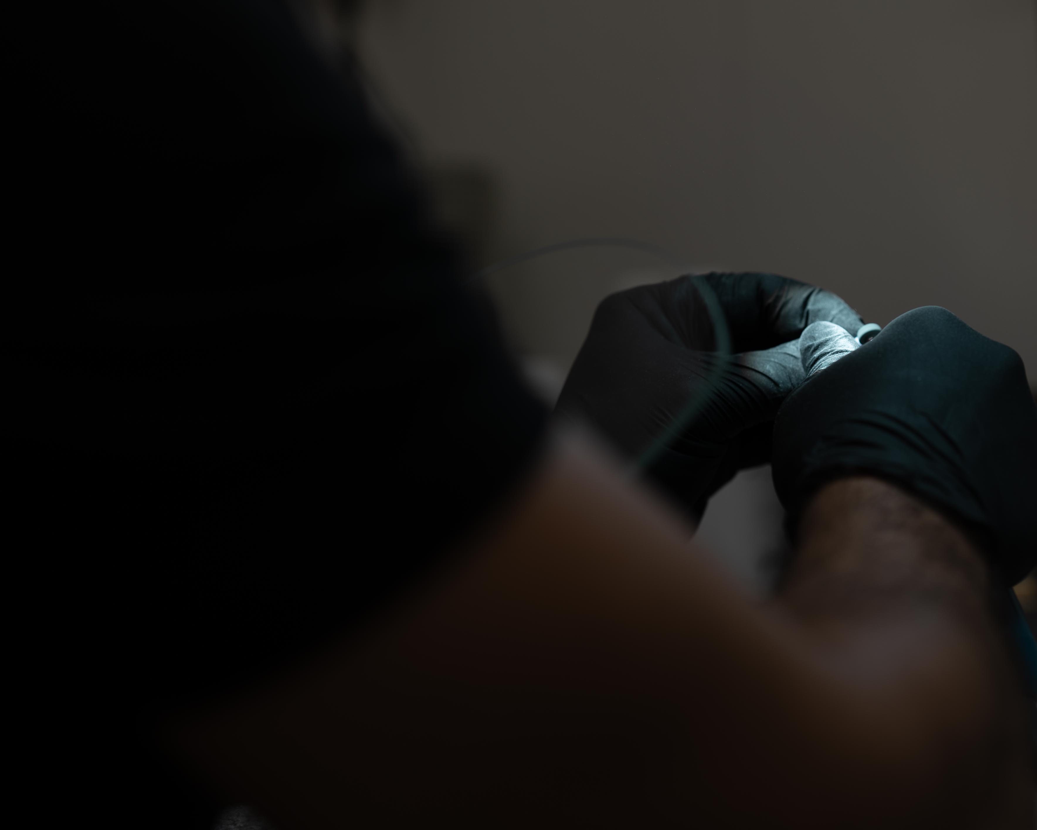 Zahnärztliche Behandlung mit Handschuhen – Detailaufnahme