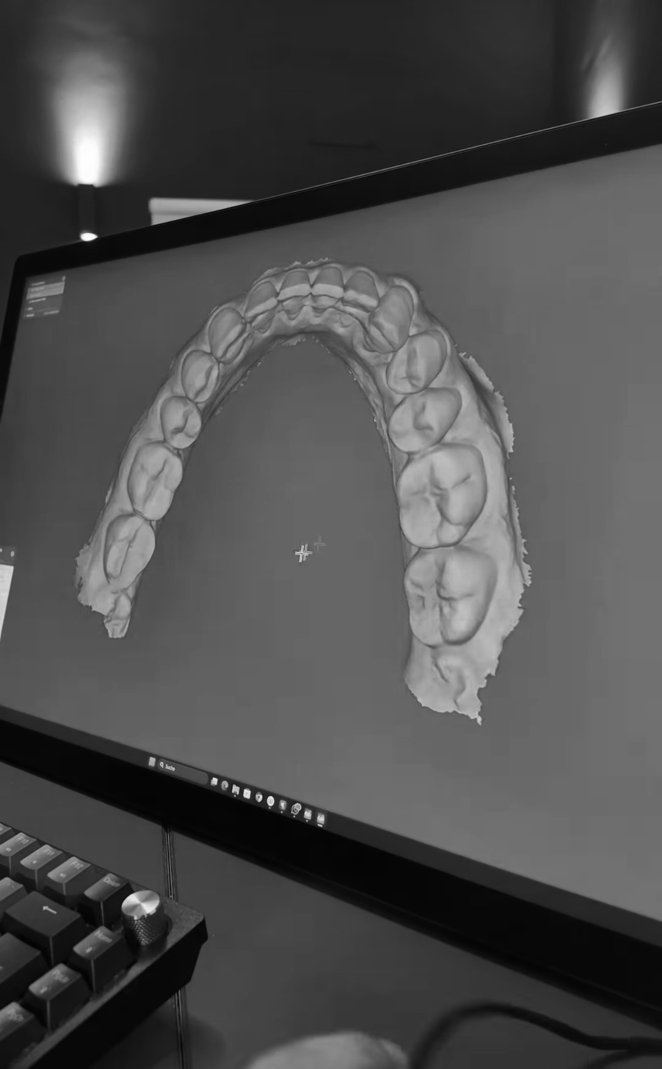 3D-Scan eines Zahnbogens auf dem Bildschirm – digitaler Intraoralscan
