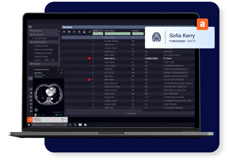 A computer showing Aidoc's interface