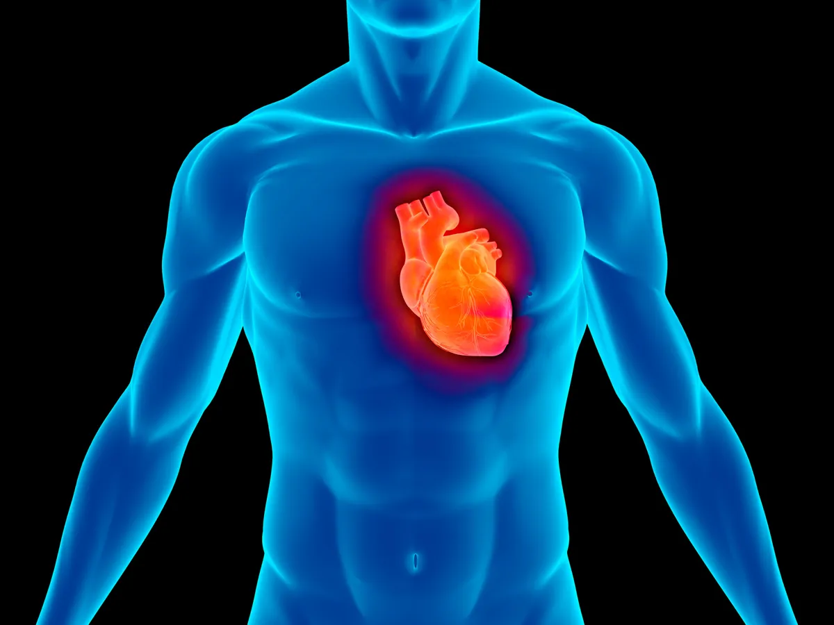 A graphic of a person with Aortic Stenosis