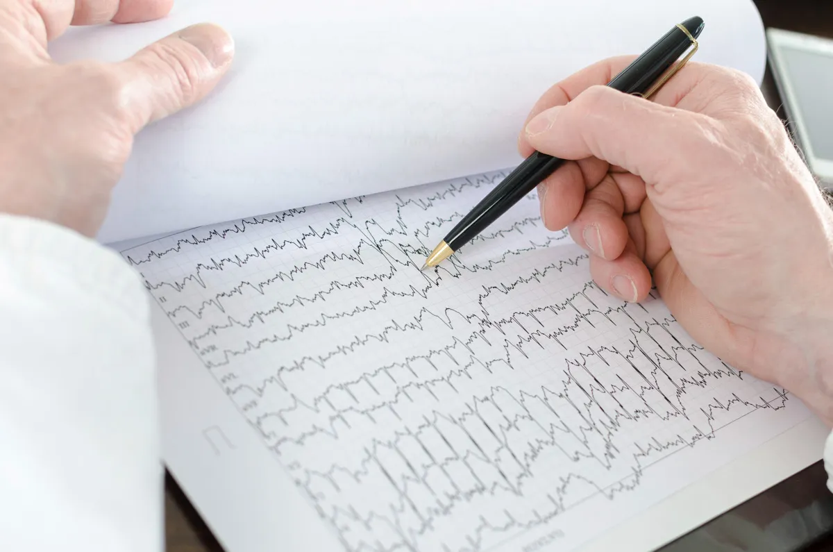 A doctor reviewing cardiogram results