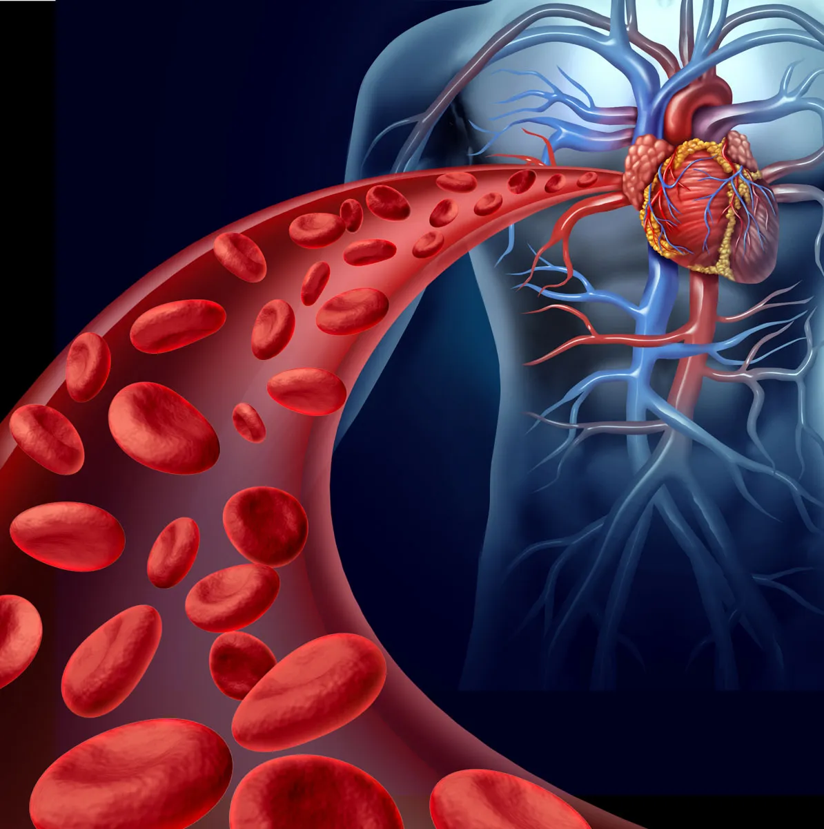 A graphic of Ischemic Heart Disease