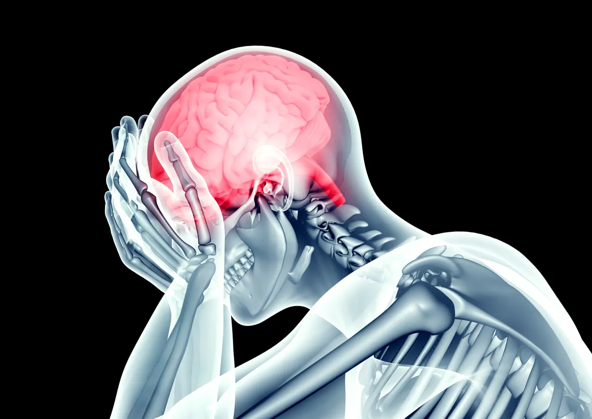 A graphic of a person having a stroke