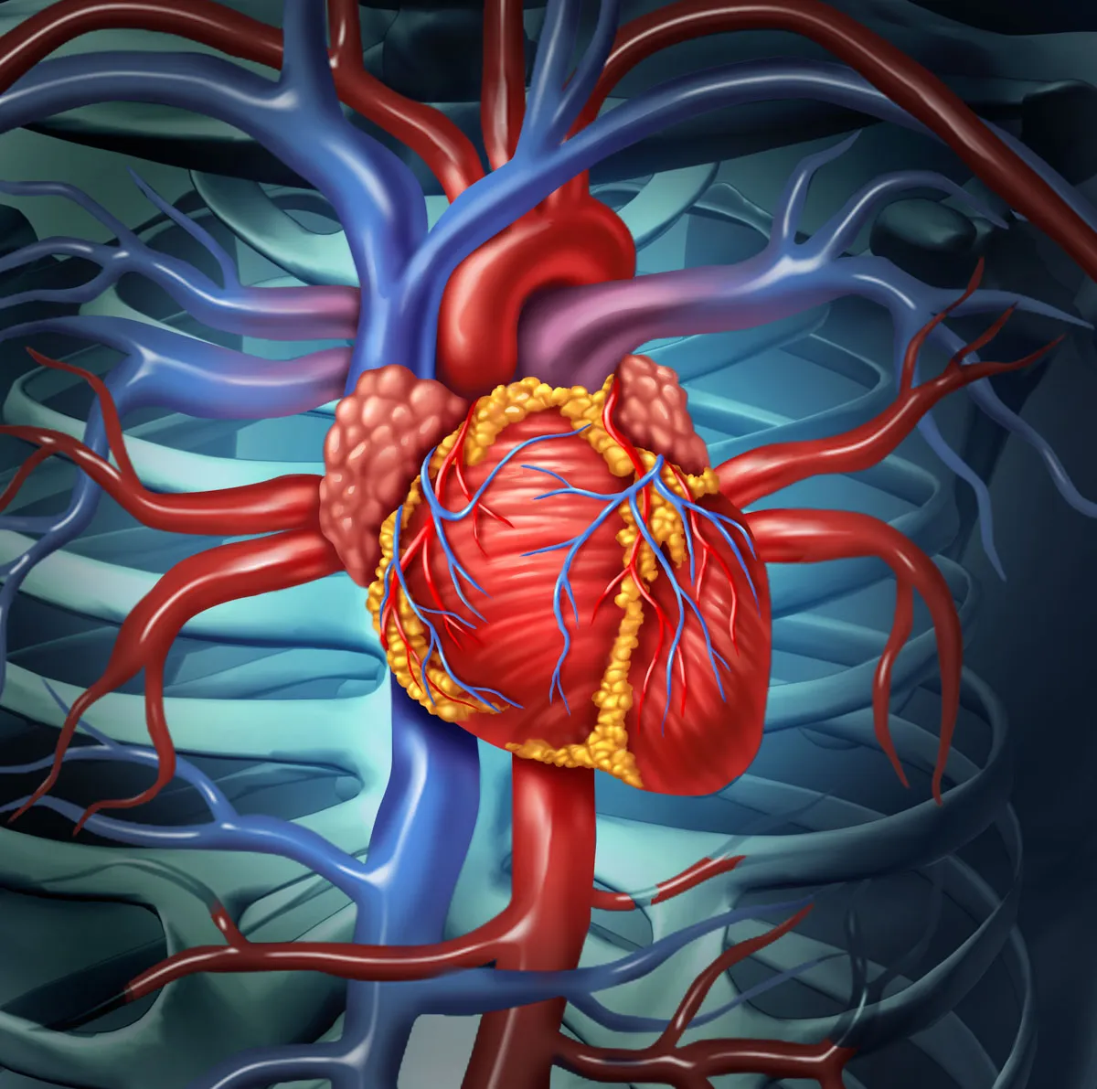 A graphic of pericarditis
